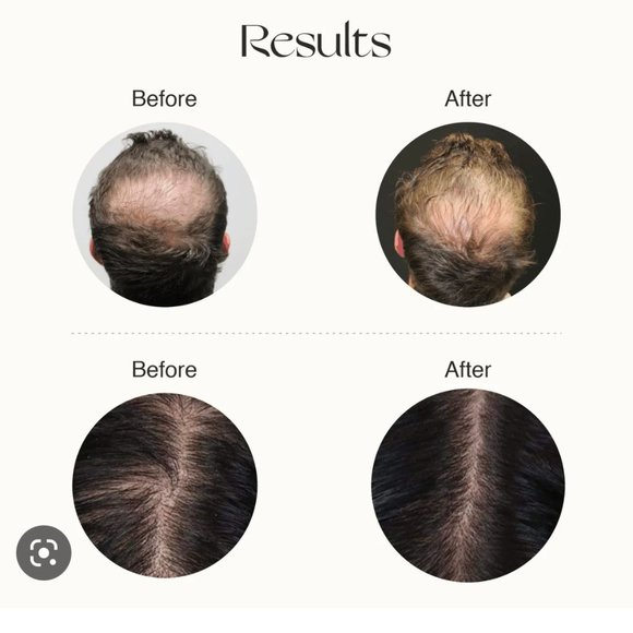 NWT 🛍 Nourish Mantra Advanced Hair Growth Serum - Picture 5 of 11